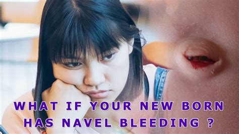 What If Your New Born Baby Has A Navel Bleeding Neosporin Review