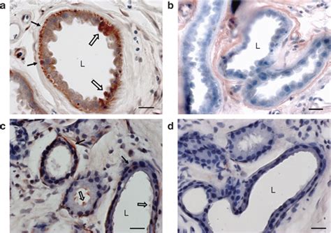 Immunolocalization Of Abcc11 Protein In Apocrine Sweat Glands Of