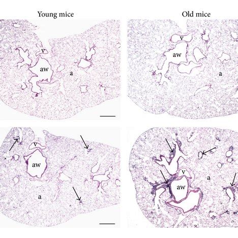 Pulmonary Histopathology A Representative Light Photomicrographs Of