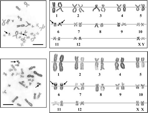 Metaphase Chromosome Plates And Karyotypes Of Male A And Female B Download Scientific