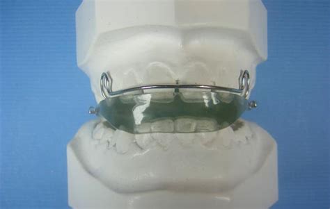 Basic Activator Accutech Orthodontic Labs