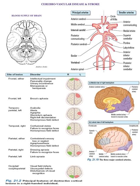 Cerebrovascular Disease And Stroke Medical Studies Neurological