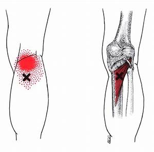 175 Best Images About Knee Issues And Leg Work On Pinterest Knee 