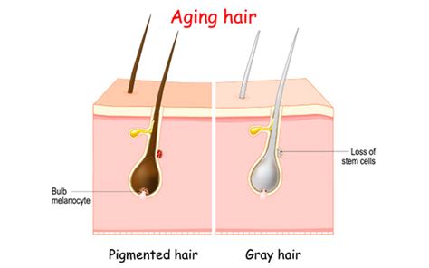 Does Plucking White Hair Lead To More Greying Skinkraft