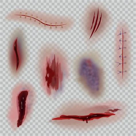 Bruise Illustrations Royalty Free Vector Graphics And Clip Art Istock