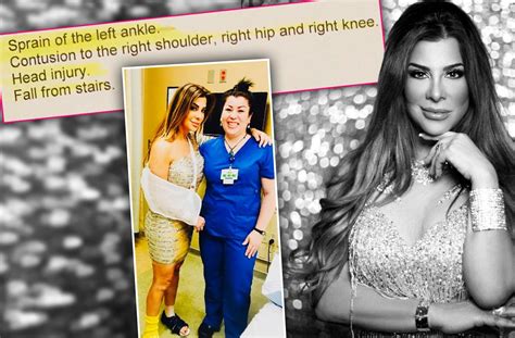 Siggy Flicker Shows Proof About Her Fake Fall With Medical Records