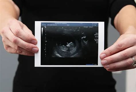 Sonogram Vs Ultrasound A More In Depth Distinction Between The Two