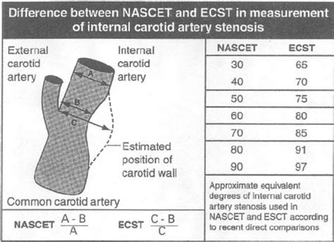 ECST And NASCET Methods For Measuring Stenosis Reproduced By