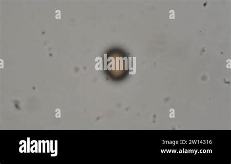 Parasite Taenia Solium Egg From Human Feces Under Microscope Testing