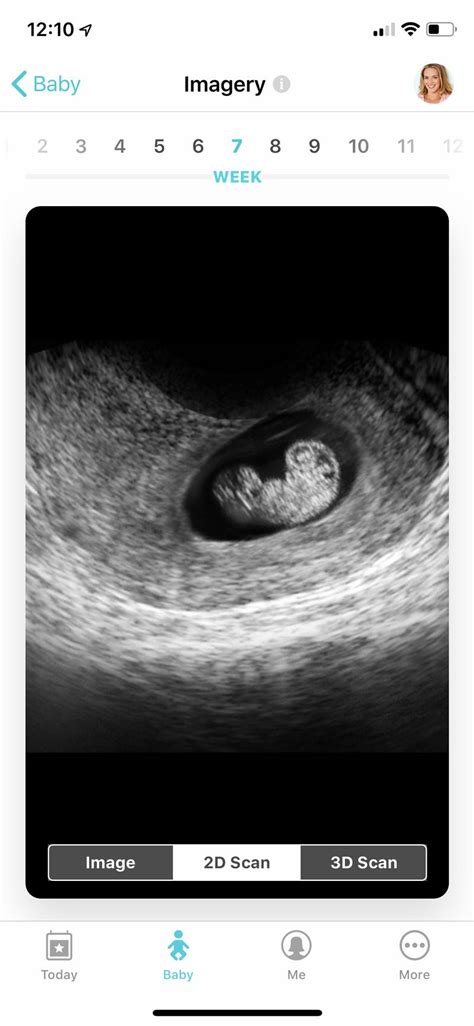 Babycenter is another popular app whether you're trying to conceive, pregnant, or adjusting to parenthood. Pin on Best Pregnancy app