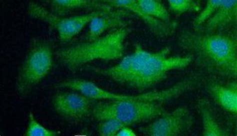 Polyclonal primary antibodies are generally raised in rabbit, goat, sheep or donkey and are an igg isotype. GLUT4 Rabbit anti-Human, Mouse, Rat, Polyclonal ...