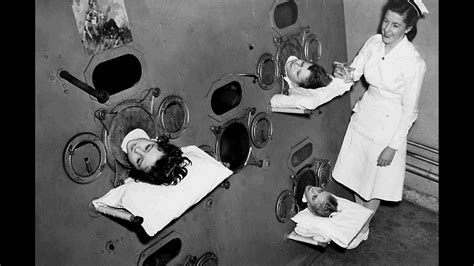 Polio Disease 1950s