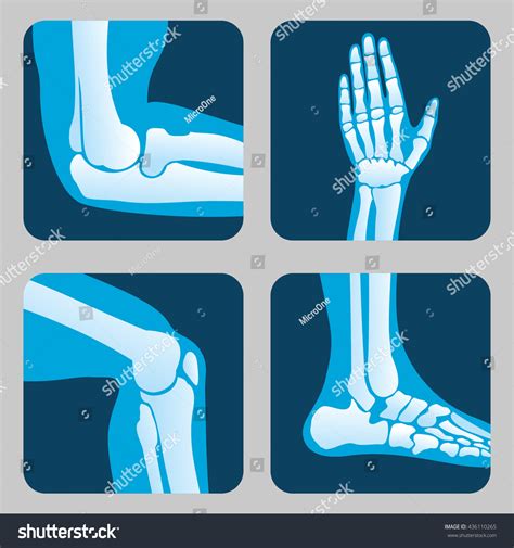 Human Joints Knee Elbow Joint Ankle Stock Vector Royalty Free 436110265