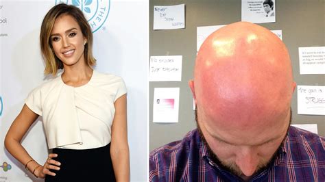Customers Say Theyre Getting Sunburns On Social Media And Amazon From