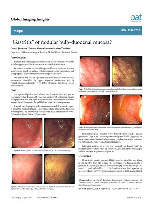 Pdf Gastritis Of Nodular Bulb Duodenal Mucosa