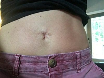 A tummy tuck can be a good way to flatten the stomach and tighten muscles in the abdomen that may have gotten loose from pregnancy, weight gain, or just general aging, but many people wonder what'll happen to the belly button as a result of the procedure. I had a mini tummy tuck on May 13, 2016. This is my belly ...