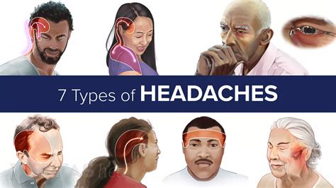 11 Tips To Relieve Headache With Neck Pain Spine Health