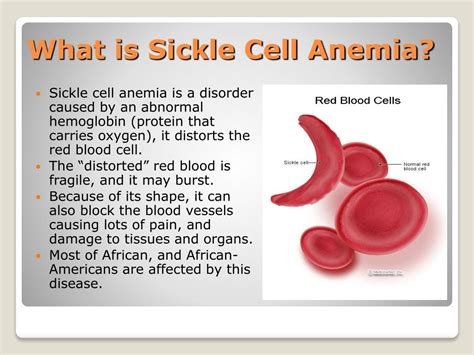 Ppt Understanding Sickle Cell Anemia Through Protein Structure Hot Sex Picture