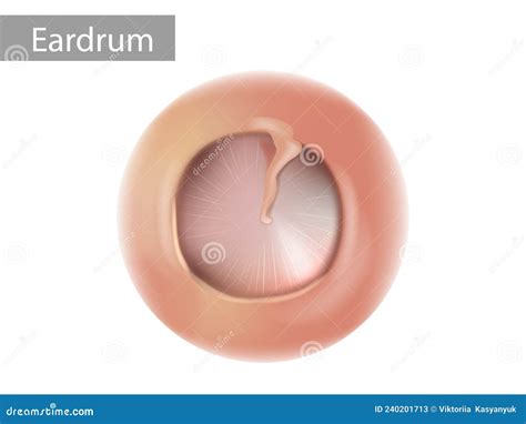 Eardrum Cartoons Illustrations Vector Stock Images Pictures To Download From