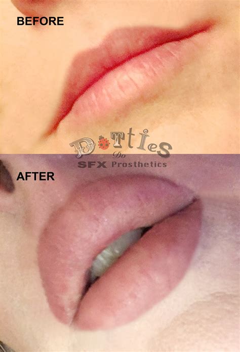 2 Sets Of Unpainted Silicone Prosthetic Lips Etsy Canada