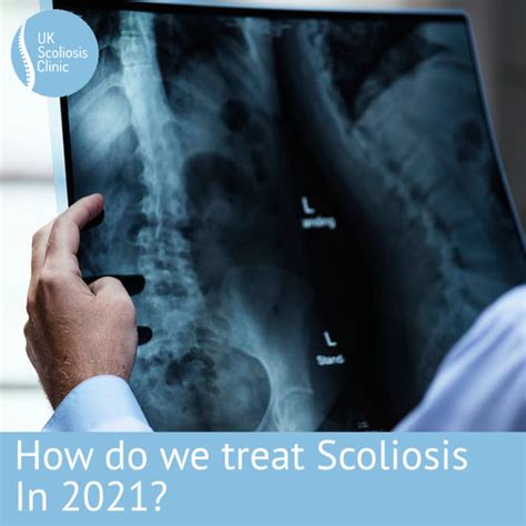 Scoliosis Clinic Uk Treating Scoliosis Without Surgery