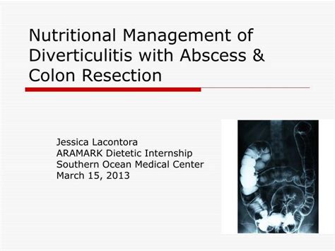Ppt Nutritional Management Of Diverticulitis With Abscess And Colon