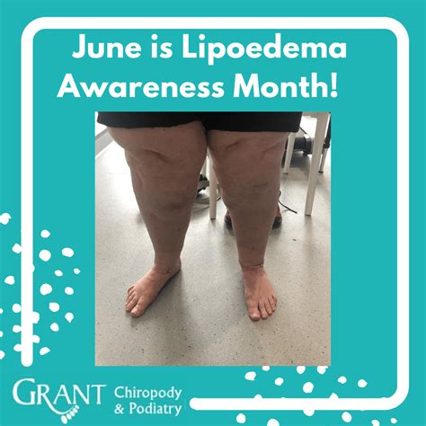 Lipoedema Awareness Month