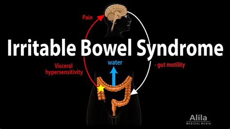 Irritable Bowel Syndrome Pathophysiology Symptoms Causes Diagnosis And Treatment Animation