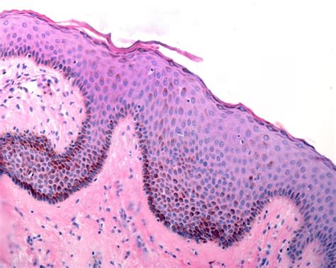 Melanin Heavily Pigmented Skin Stock Image Image Of Epithelium