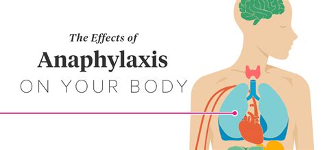 15 Effects Of Anaphylaxis On The Body