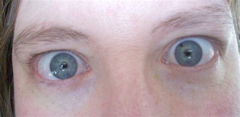 If You Have Blue Eyes Science Says Theyre Actually Brown