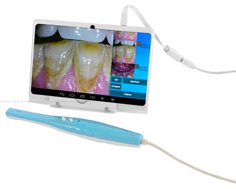 cf 688a intra oral camera with usb otg dental camera for android phone and android tablet