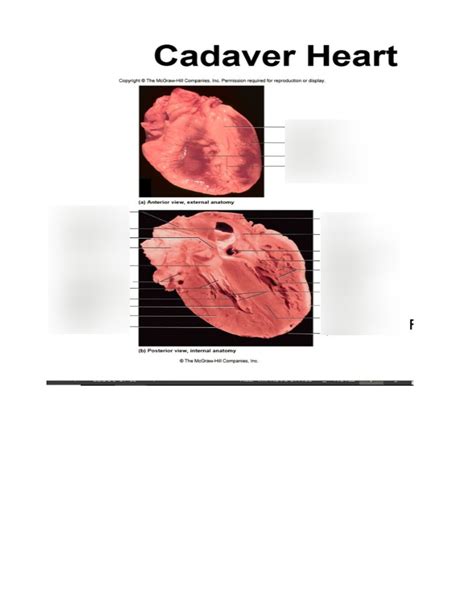 Cadaver Heart Diagram Quizlet