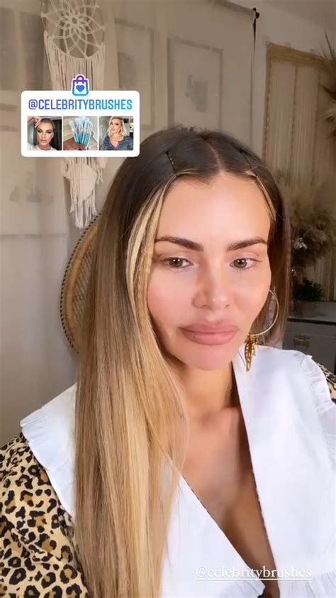 Towies Chloe Sims Removes Fillers After Years Of Cosmetic Work To Embrace Natural Looks Irish