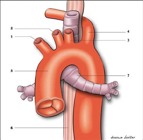 Jürg schmidli chief of vascular surgery inselspital. Anatomy of an aberrant right subclavian artery. Right ...