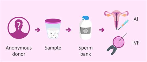 How Is Sperm Donation Explained Step By Step