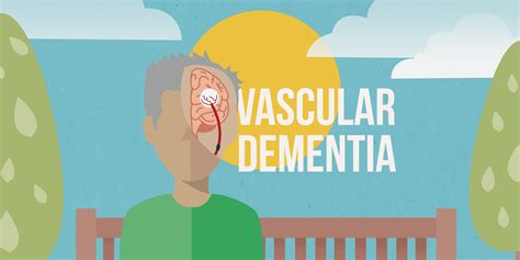 Goodinfo Ups And Downs Of Vascular Dementia