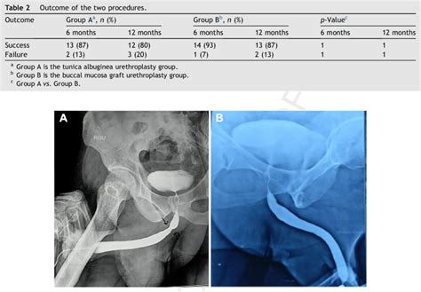 Retrograde Urethrogram Of A Patient A Pre Operative B 3 Months