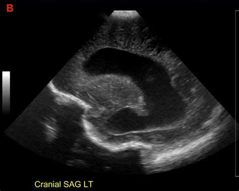 Coronal And Left Sagittal Ultrasound Of A Preterm Newborn Notes
