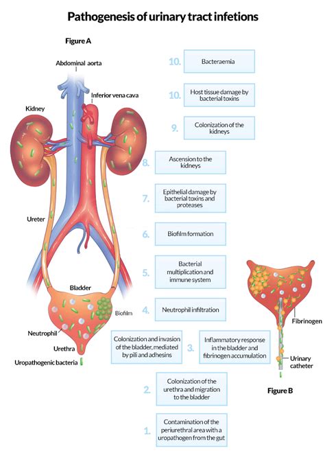 Ceufast Utis Complicated Including Pyelonephritis In Adults