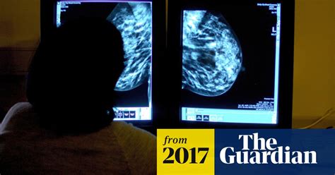 New Therapy Offers Hope Against Incurable Form Of Breast Cancer Cancer Research The Guardian