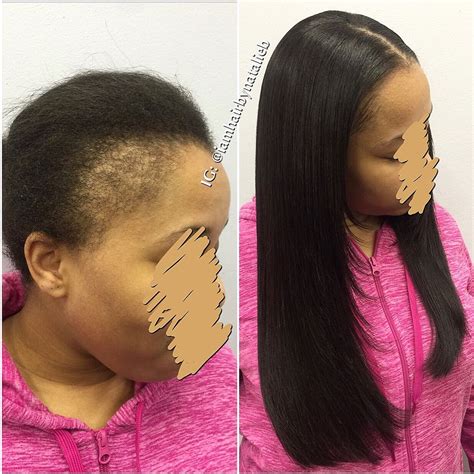 Traditional Sew In Hair Weave On Client With Thin Edges Her