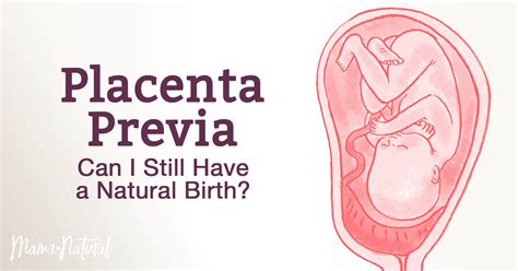 Placenta Previa Can I Still Have A Natural Birth Mama Natural