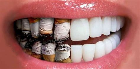 Smoking And Gum Disease What You Should Know Britten Perio