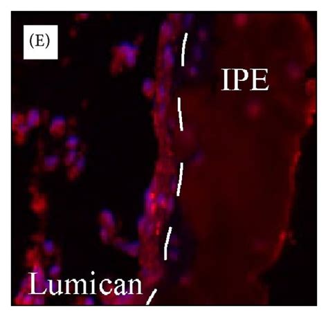Lumican Staining In Human Iris Pigment Epithelial Cells Ipe And Iris