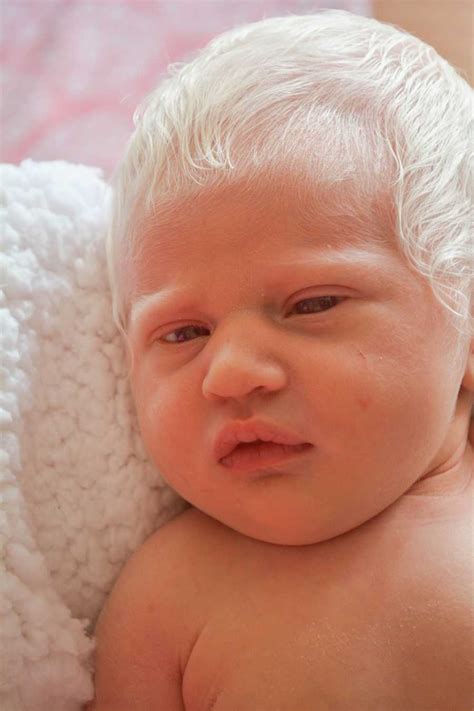 Baby Boy Born With Snow White Hair Dubbed “prince Charming” Zinzix