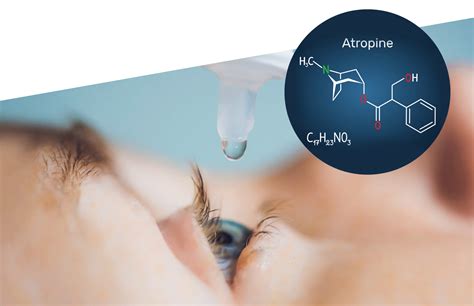 Topical Low Dose Atropine To Slow Myopia Review Of Myopia Management