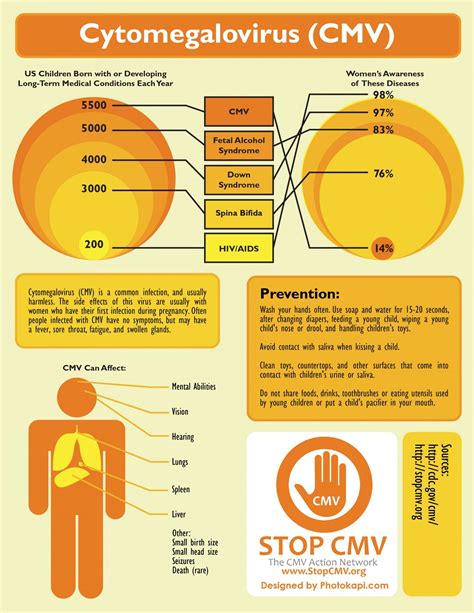 Infection A Cmv Infection Cytomégalovirus Symptômes Succed