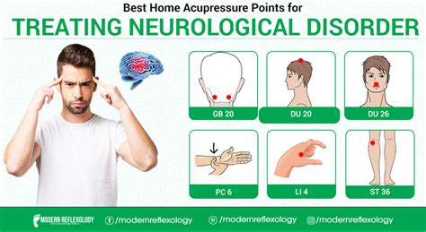 Acupressure Points For Treating Neurological Disorders Modern Reflexology