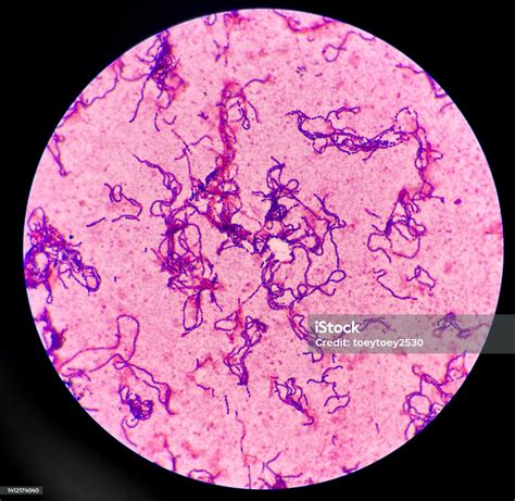 Gram Positive Cocci In Chain Stock Photo Download Image Now